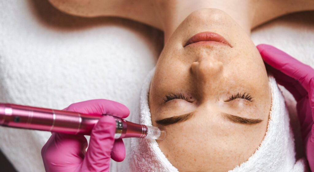 Close up,Portrait,Of,Cosmetologist,Beautician's,Hands,Doing,Mesotherapy,With,Dermapen.