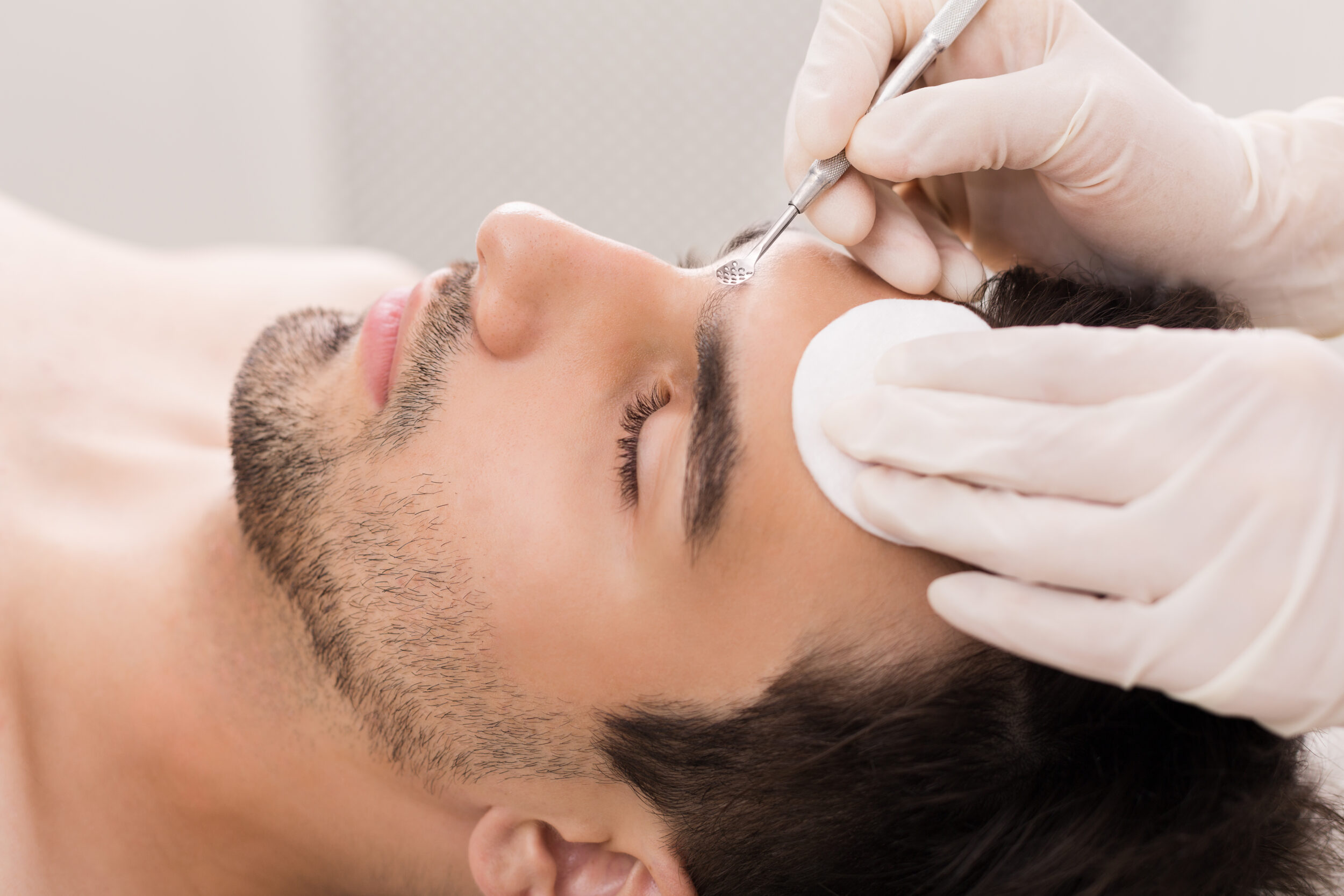 Cosmetician,Using,Blackhead,Remover,For,Cleaning,Man,Face,In,Spa