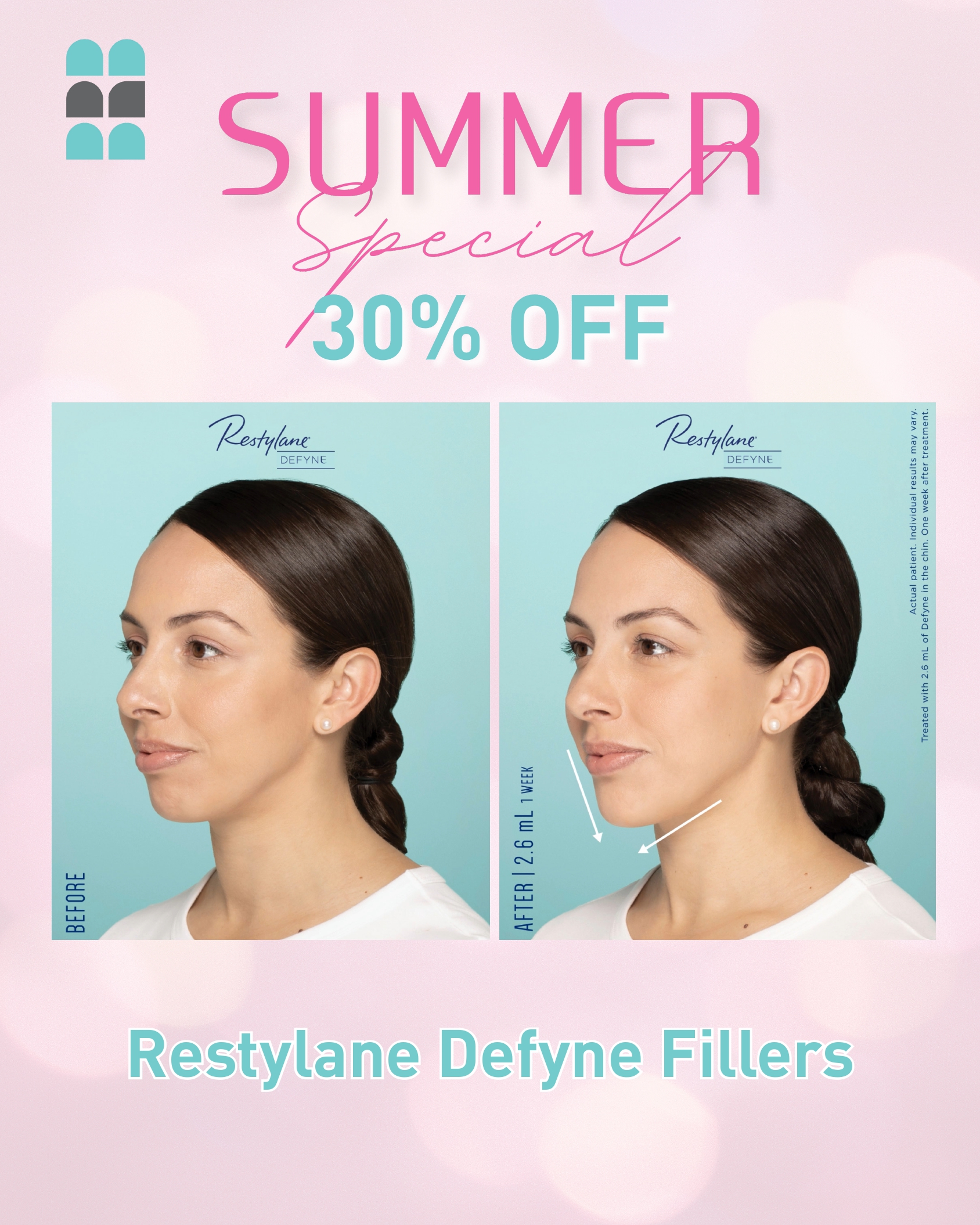 Restylane® Defyne