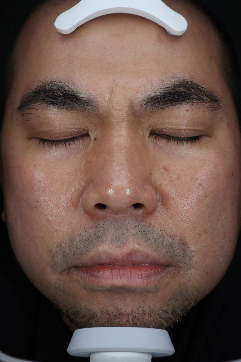 Before Image: MOXI - front