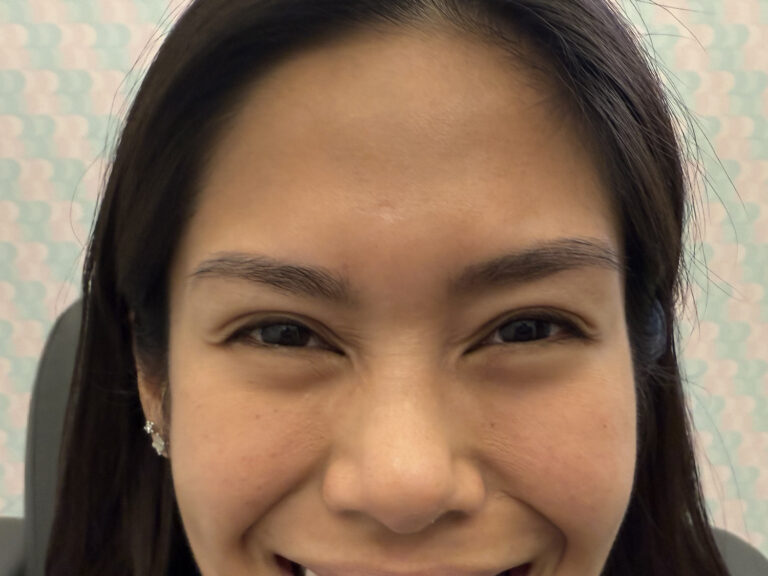 After Image: Xeomin – Crow’s Feet - front