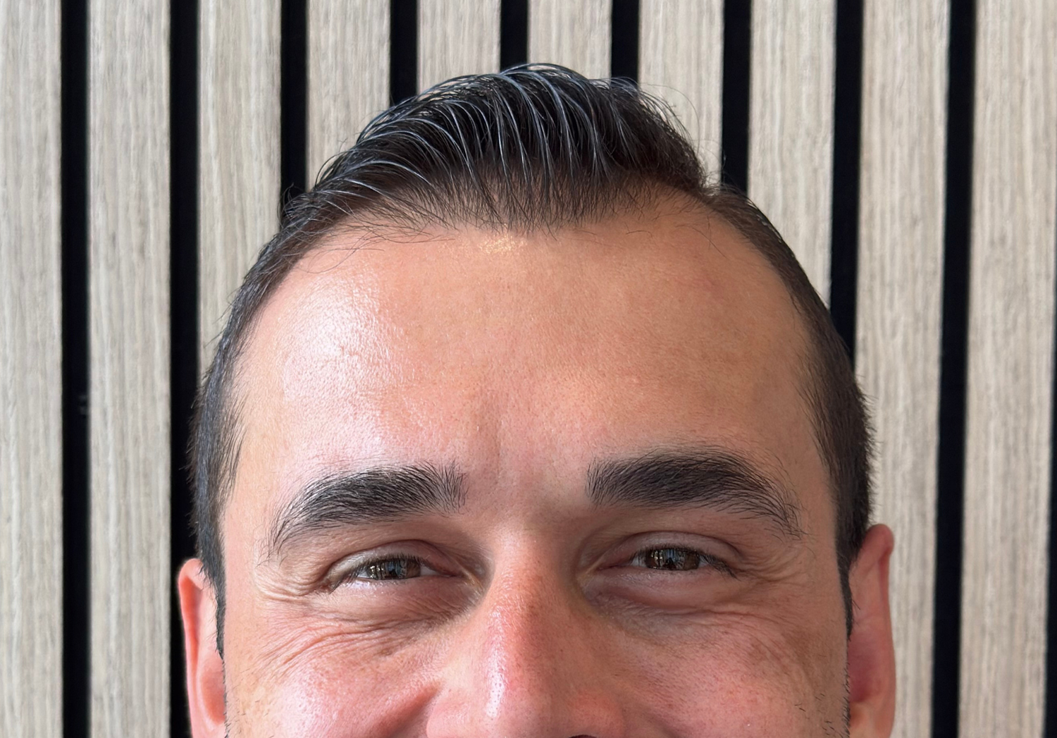 After Image: Xeomin - front