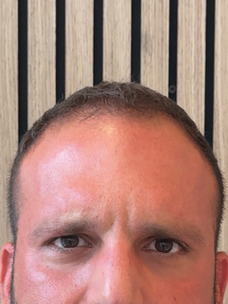 After Image: Xeomin - front