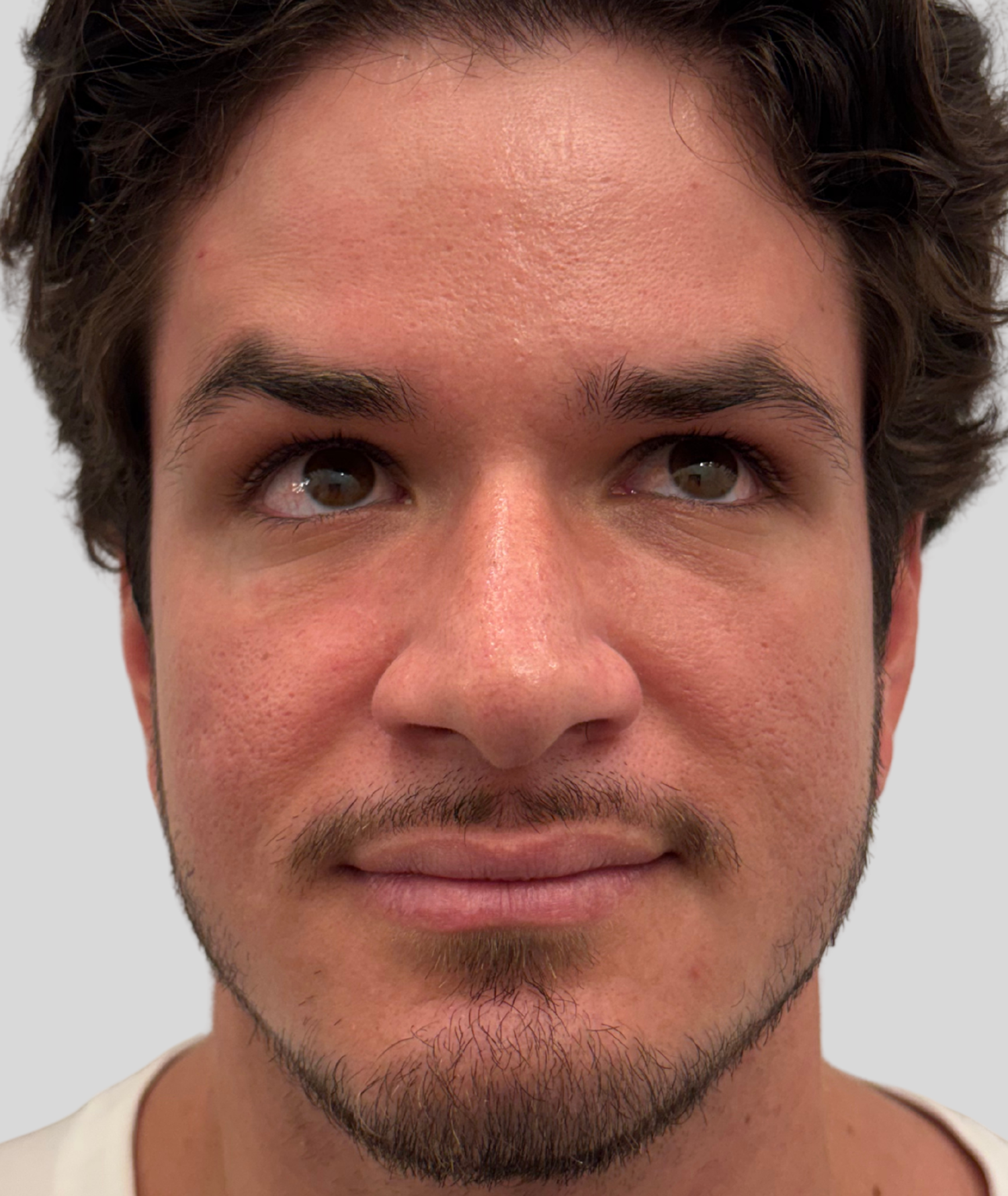 After Image: Xeomin - front