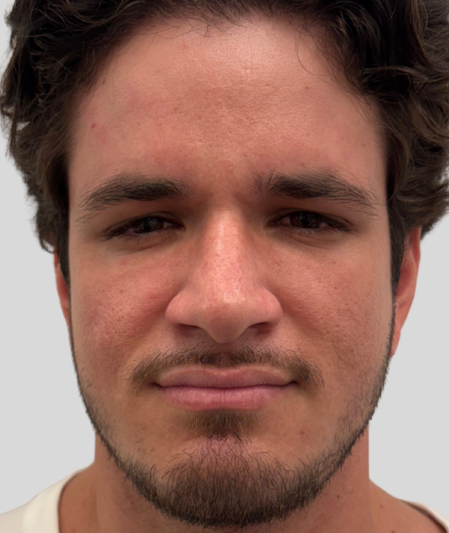 After Image: Xeomin - front