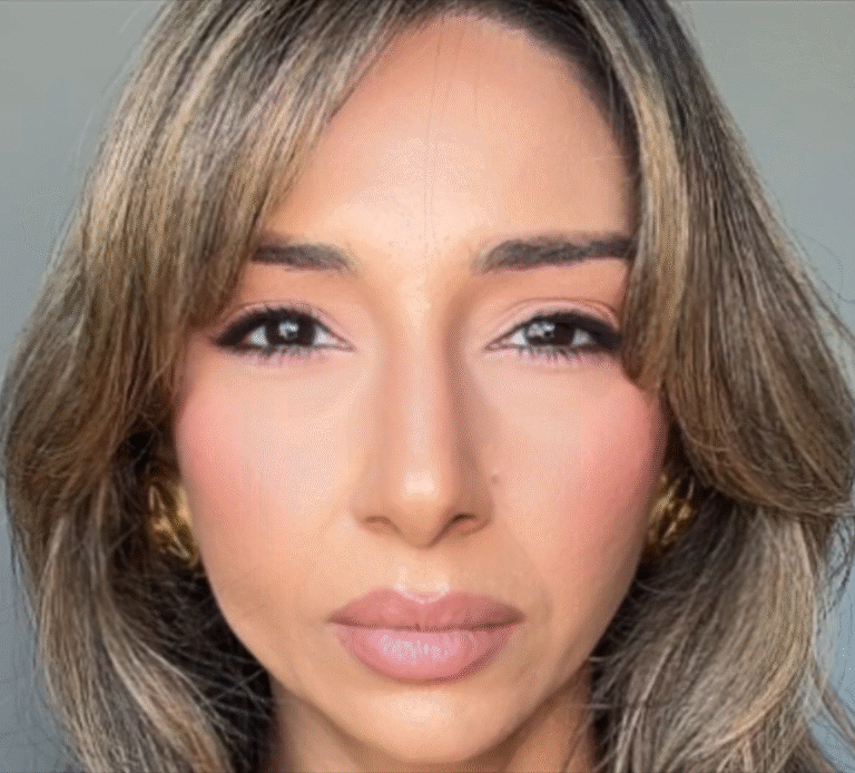 After Image: Xeomin - front