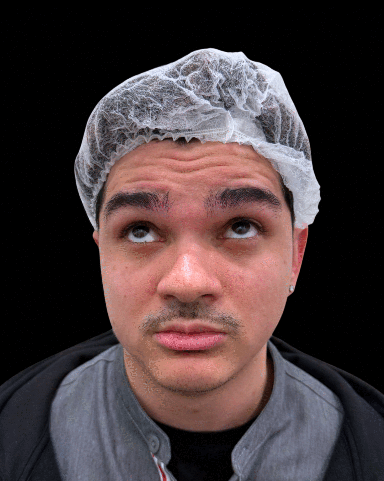 Before Image: Xeomin - front