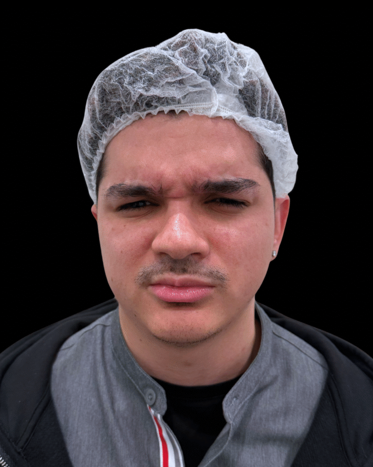 Before Image: Xeomin - front