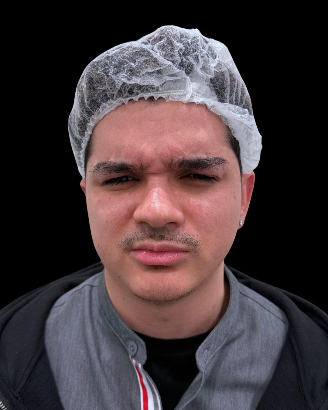 Before Image: Xeomin - front