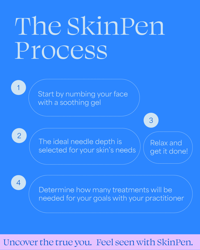 The 4 step SkinPen Elite treatment process The 4 step SkinPen Elite treatment process