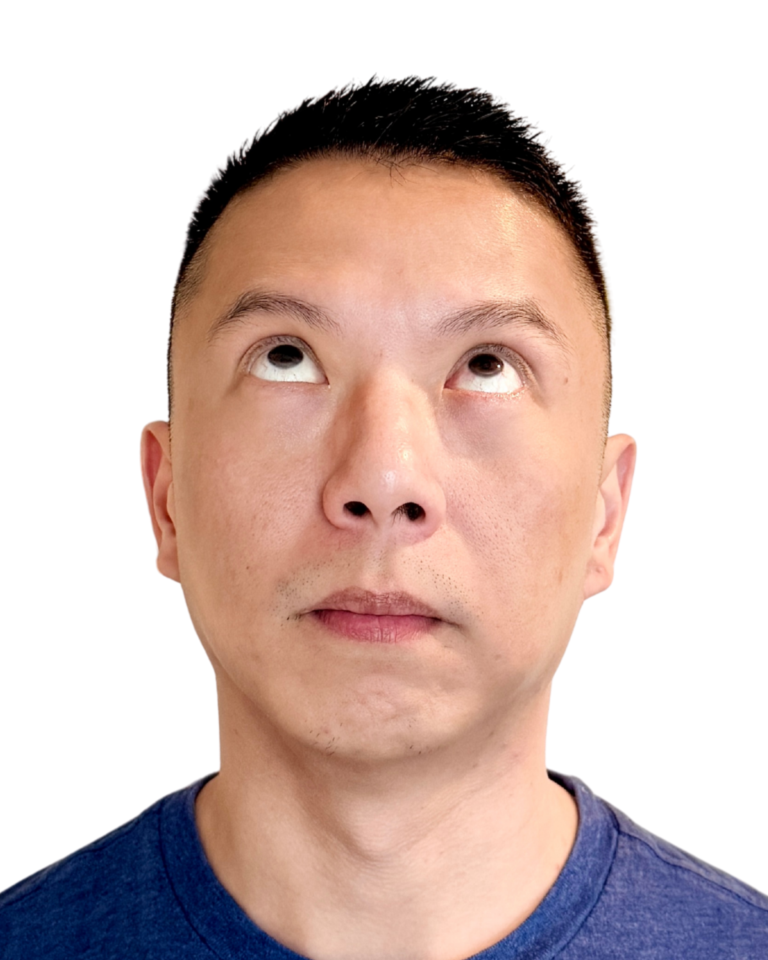 After Image: BOTOX -