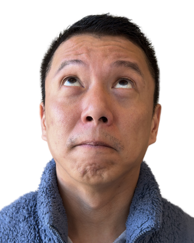 Before Image: BOTOX -