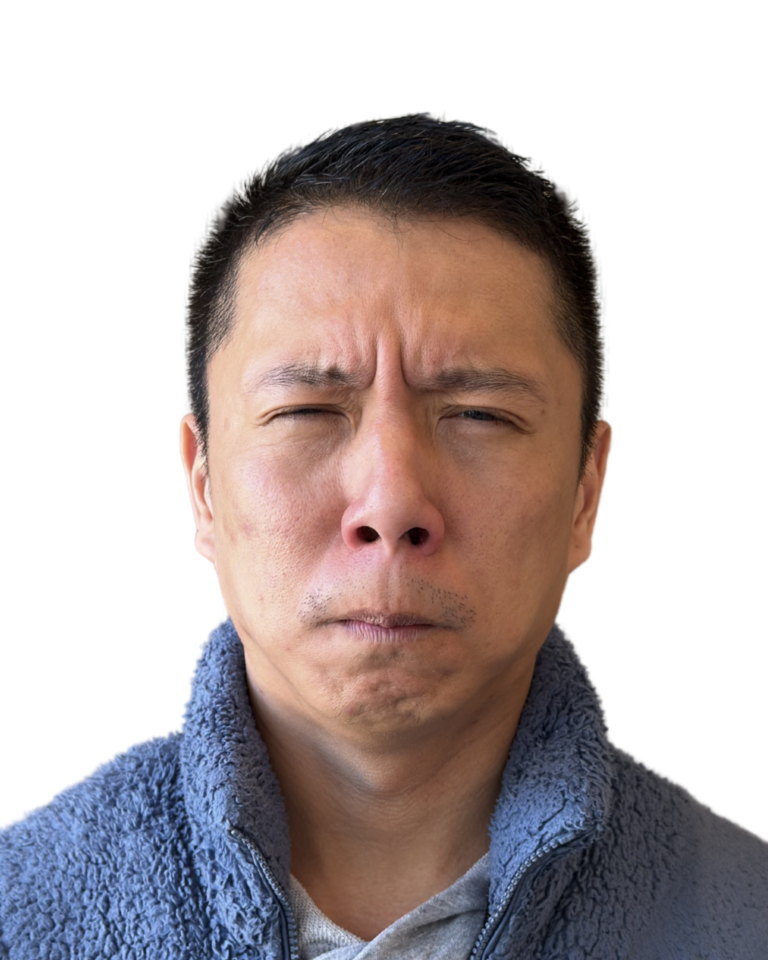 Before Image: BOTOX -