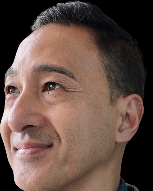 Before Image: Xeomin - left-front-oblique