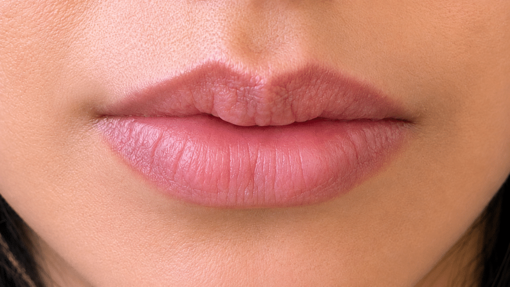 Before Image: JUVEDERM VOLBELLA XC – LIP FILLER - front